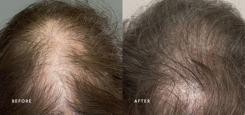 Hair treatment results