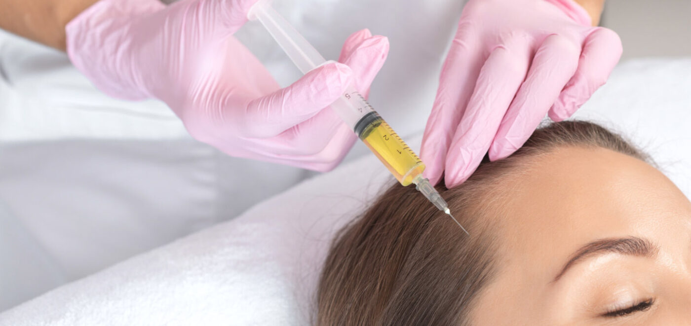 PRP Treatment