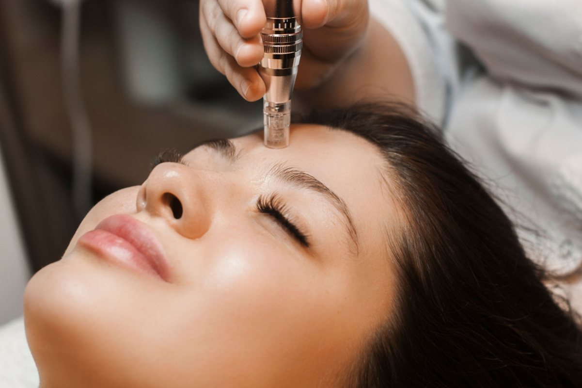 Micro-needling Treatment