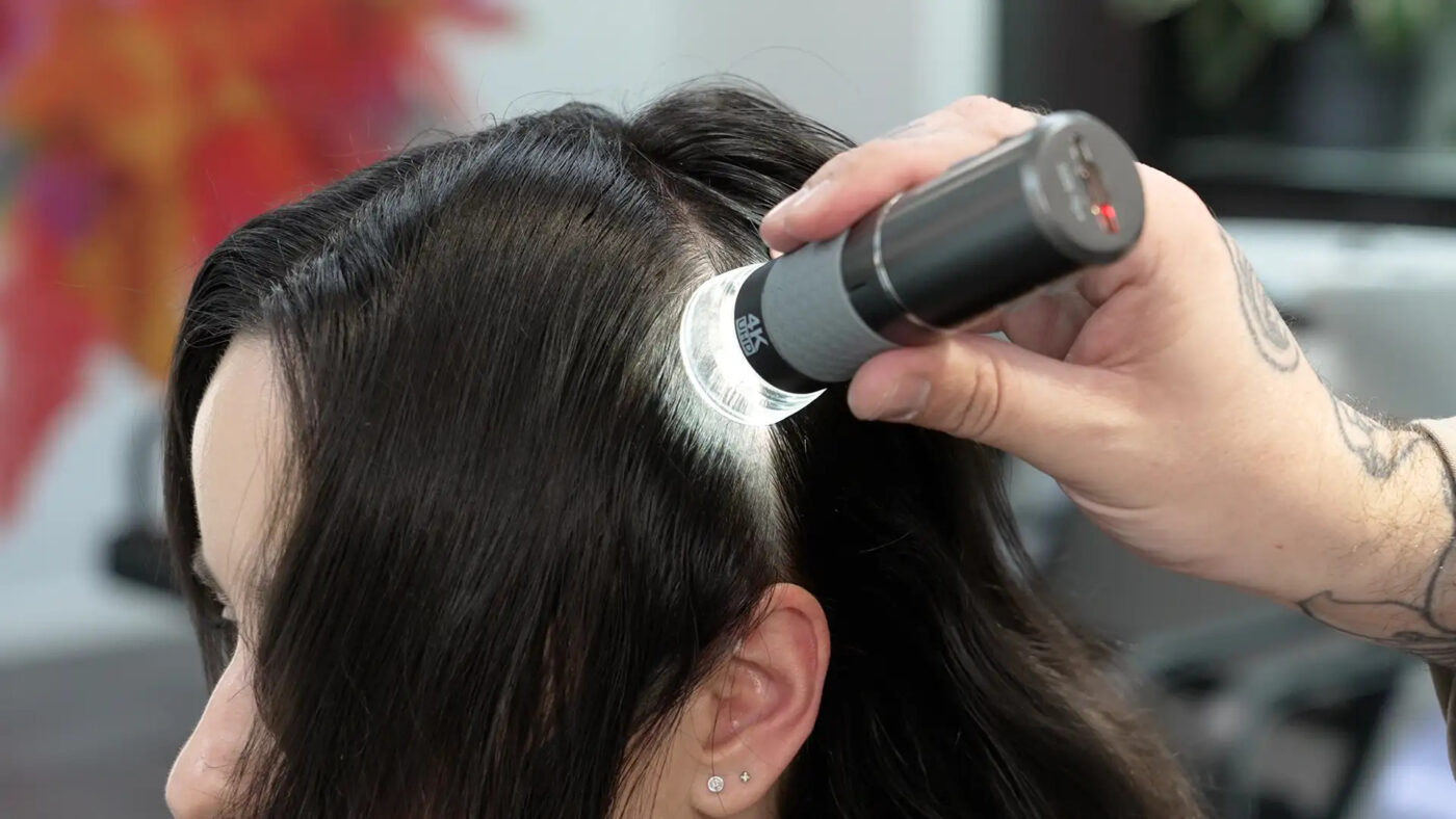 Professional Scalp Analysis