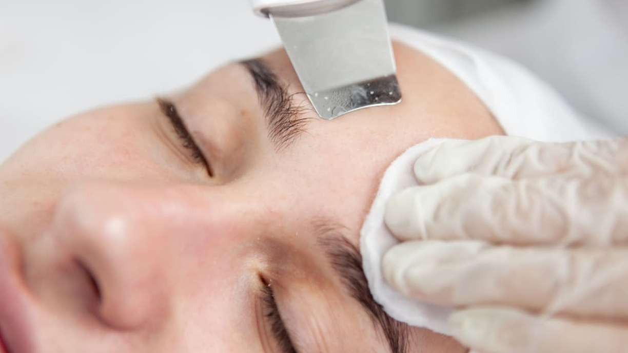 ultrasonic facial exfoliation